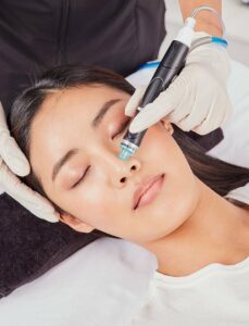 Trẻ Hóa Da Mặt Bằng Công Nghệ Cao: Những Phương Pháp Mới Mang Lại Kết Quả Vượt Trội